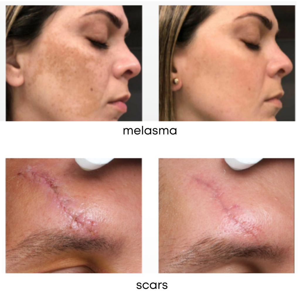 advatx_beforeandafter-2(1)